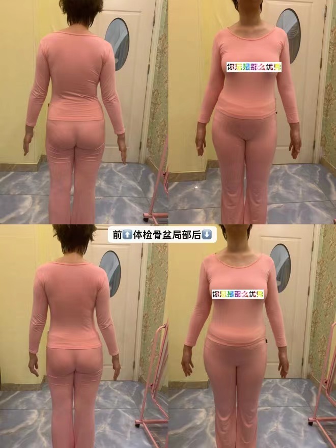 骨盘调整体验效果